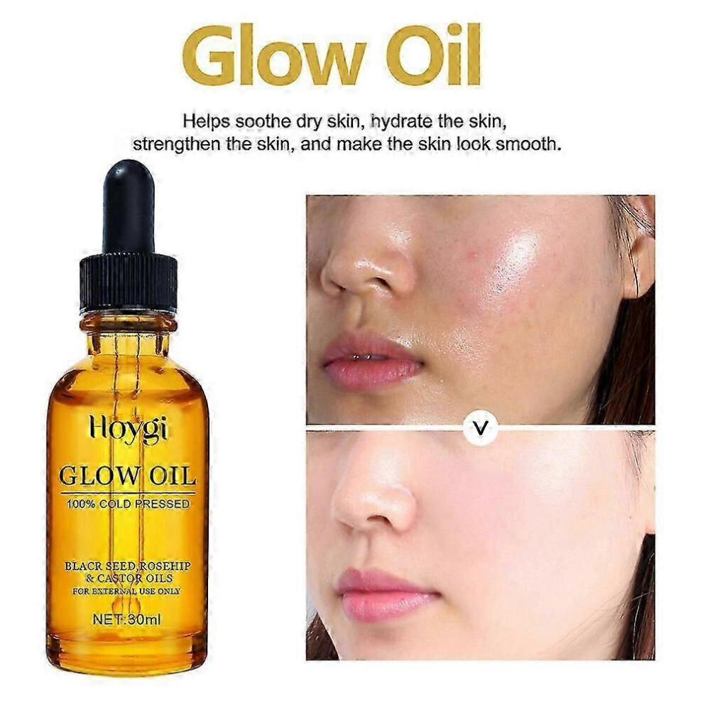 Lalenas Oil Black Seed Oil, Rosehip Oil, Castor Oil, Lalena Rosehip Oil Black Seed Oil And Castor Oil, Cold Pressed Lilinas Oil