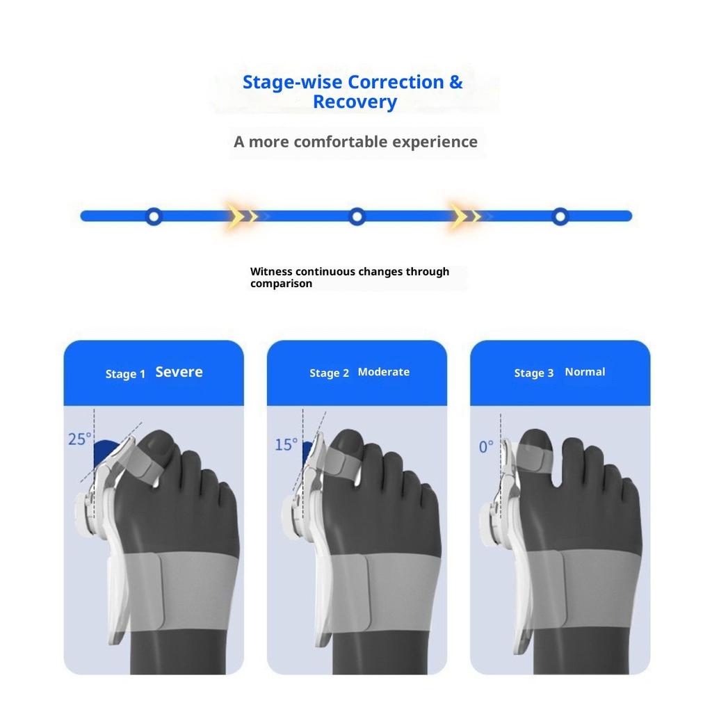 Korektor vbočeného palce Nastavitelný knoflík Oddělovač prstů palce Velikost pro muže i ženy Korektor překrývajících se kostí palce
