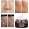 Newest Whitening Facial Cream Repair Fade Freckles Remove Dark Spots Melanin Remover Brightening Face Freckle Cream