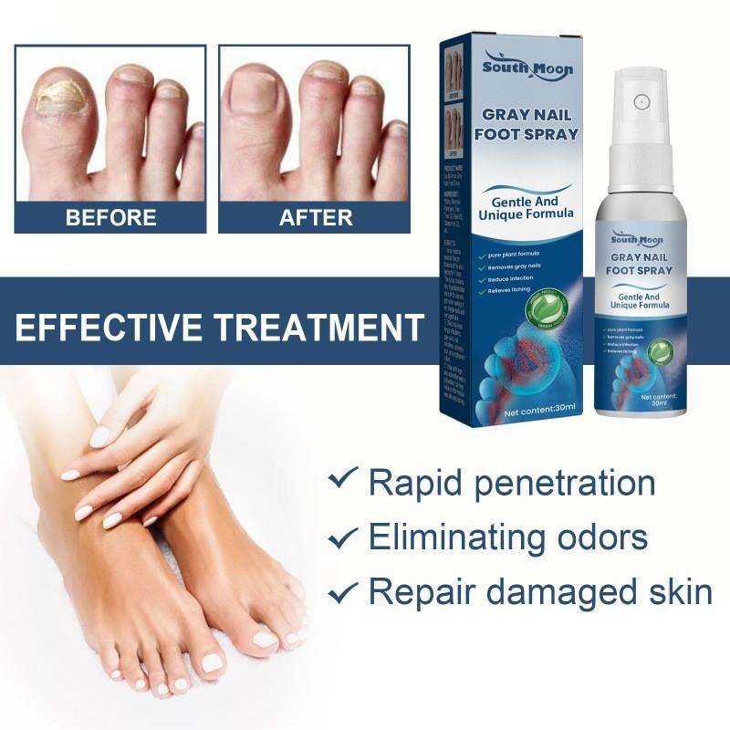 South Moon Gray Nail Repair Spray Nourishing Moisturizing Treatment For Dry And Odorous Nails