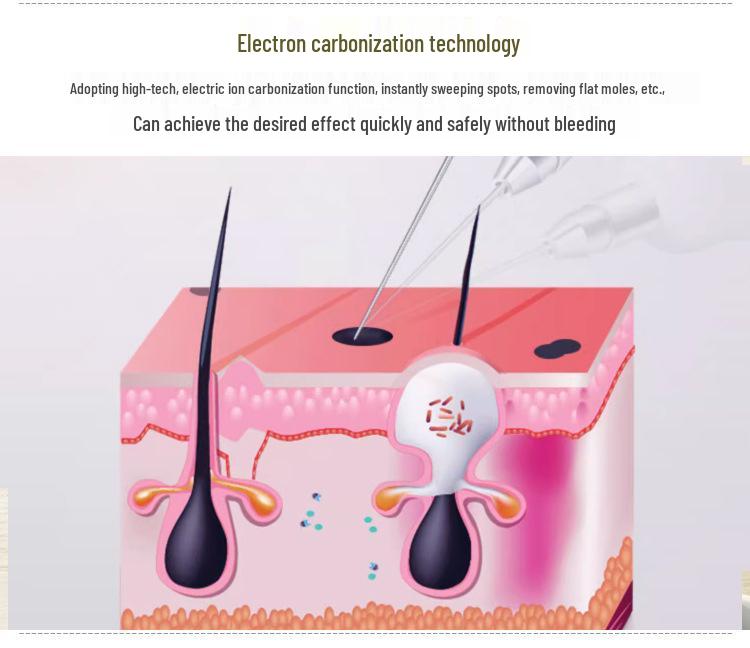 Park Si-yeon Laser Freckle & Mole Removal Pen for Home and Salon Use – Tattoo & Eyebrow Removal Device