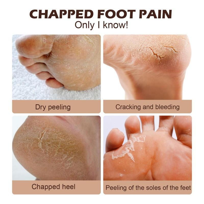 Eelhoe Horse Oil Foot Cream Hydrating And Nourishing Moisturizer For Dry Cracked Skin