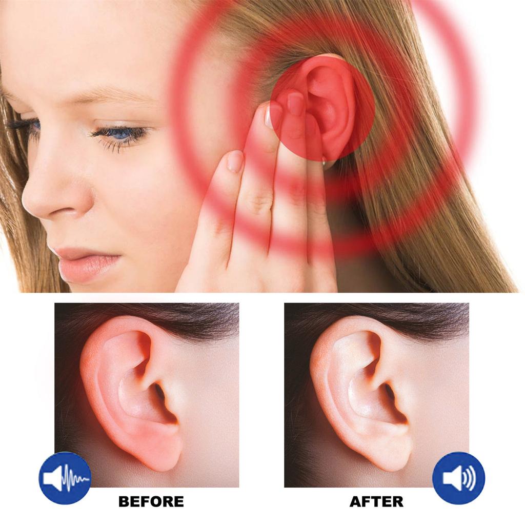 60ml Tinnitus Relief Spray Herbal Safe Ingredients Ear Care Spray for Tinnitus Ear Back Ear Discomfort