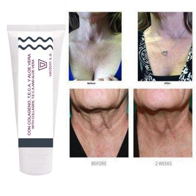 Cream Face and Neck Cream  Neckline Cream Wrinkle Smooth Anti Aging Cream