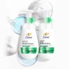 POND'S Anti-Acne Cleansing Gel & Dove Oil Control Facial Foam Set