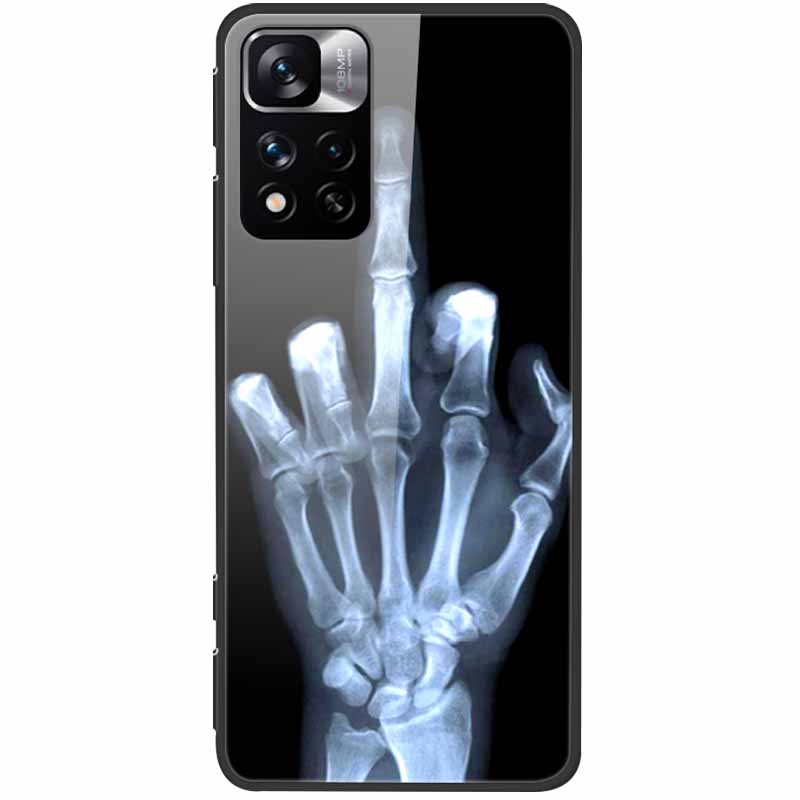 Tempered Glass Case For Xiaomi Redmi Note 11 Pro+ 5G Cover Hard Protective Funda for Redmi Note 11 Pro Plus 5G Soft Bumper 6.67