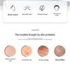 ZGTS192 Titanium Microneedle Derma Roller for Beauty Salon & Home Use