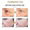 2x  30ml Turmeric Oil Pure Natural Pleasant Moisturizing Anti-aging Serum Lighten