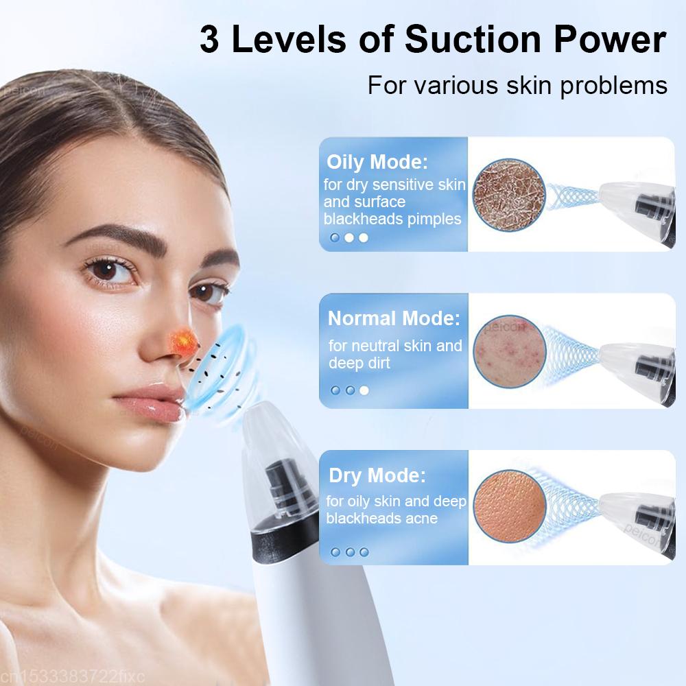 Blackhead Remover Pore Cleaner Black Dots Remover Electric Black Point Extractor Pimple Acne Blackhead Black Dots Vacuum Cleaner