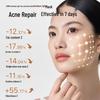 Miguang L2 Pro LED Light Therapy Facial Mask
