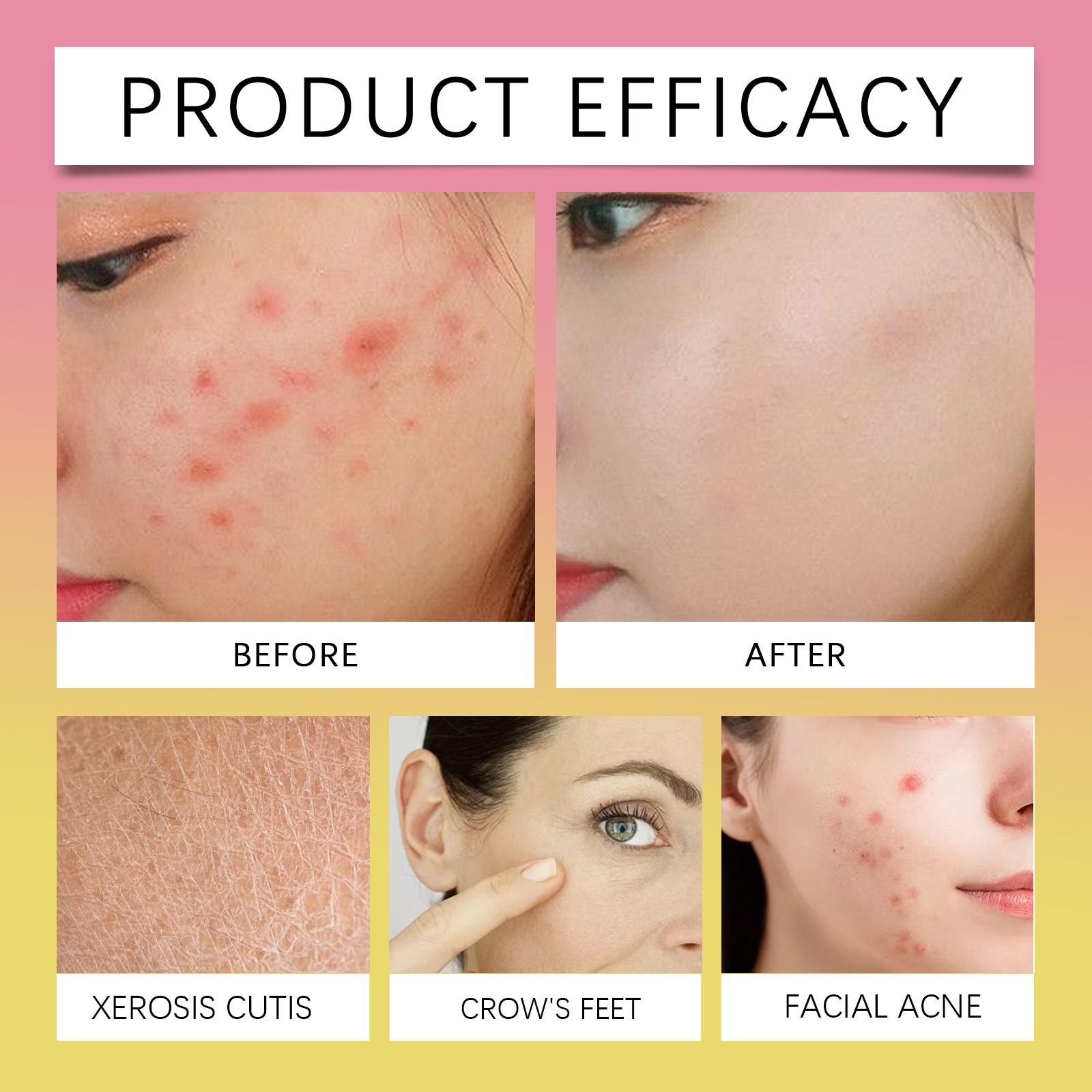 Очищающие подушечки для лица и тела — фото 6