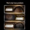 Clear Men's Anti-Dandruff & Anti-Hair Loss Shampoo