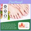 Sumifun Nail Care Ointment With Soothing Formula For Foot And Hand Maintenance