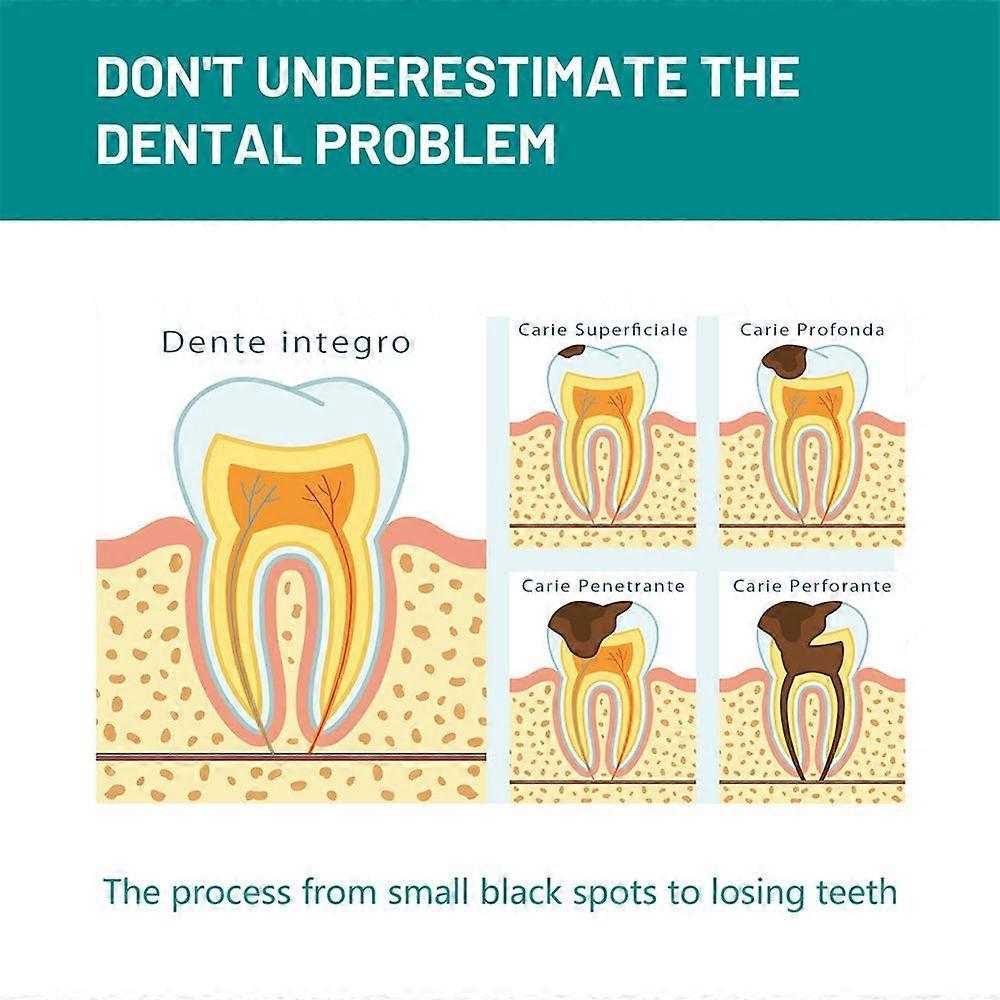 3pcs Teeth Cleansing Mousse Remove Plaque Stains Breath Freshen Dental Gingival Repair Caries Oral Hygiene Foam Whitening Toothpaste