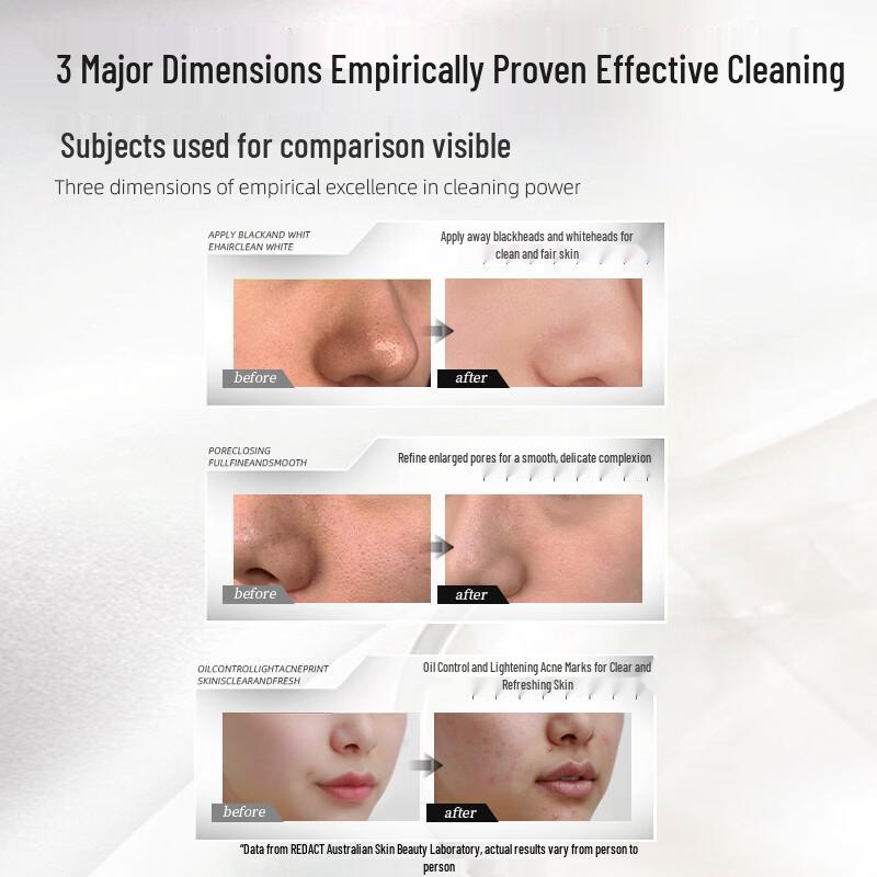 Layanana Australian Blackhead Removal Mud Mask