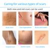 1/2/3Pcs 4cm Wide X1.5m Long Silicone Scar Management Skin Thicken Patch Tape Hypoallergenic Nursing Supplies for Scar Treatment