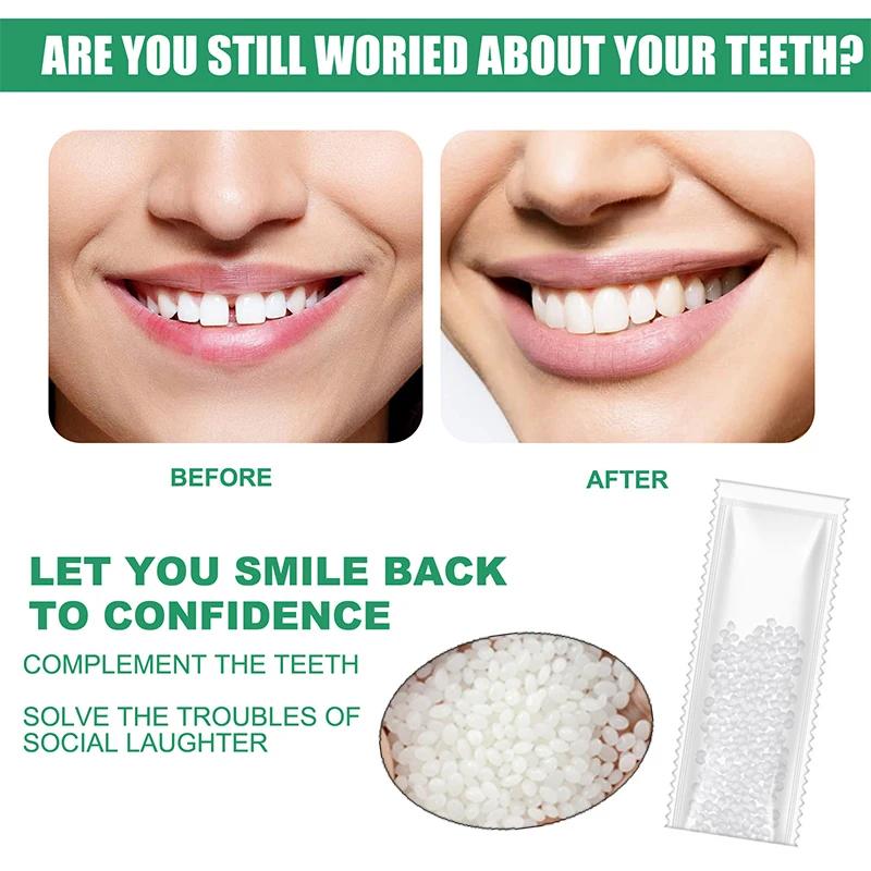 10g50g/30ml Resin Tooth Repair Glue Shapeable Teeth Gaps Filling Solid Glue Temporary Teeth Repair Falseteeth Glue Safety Dental