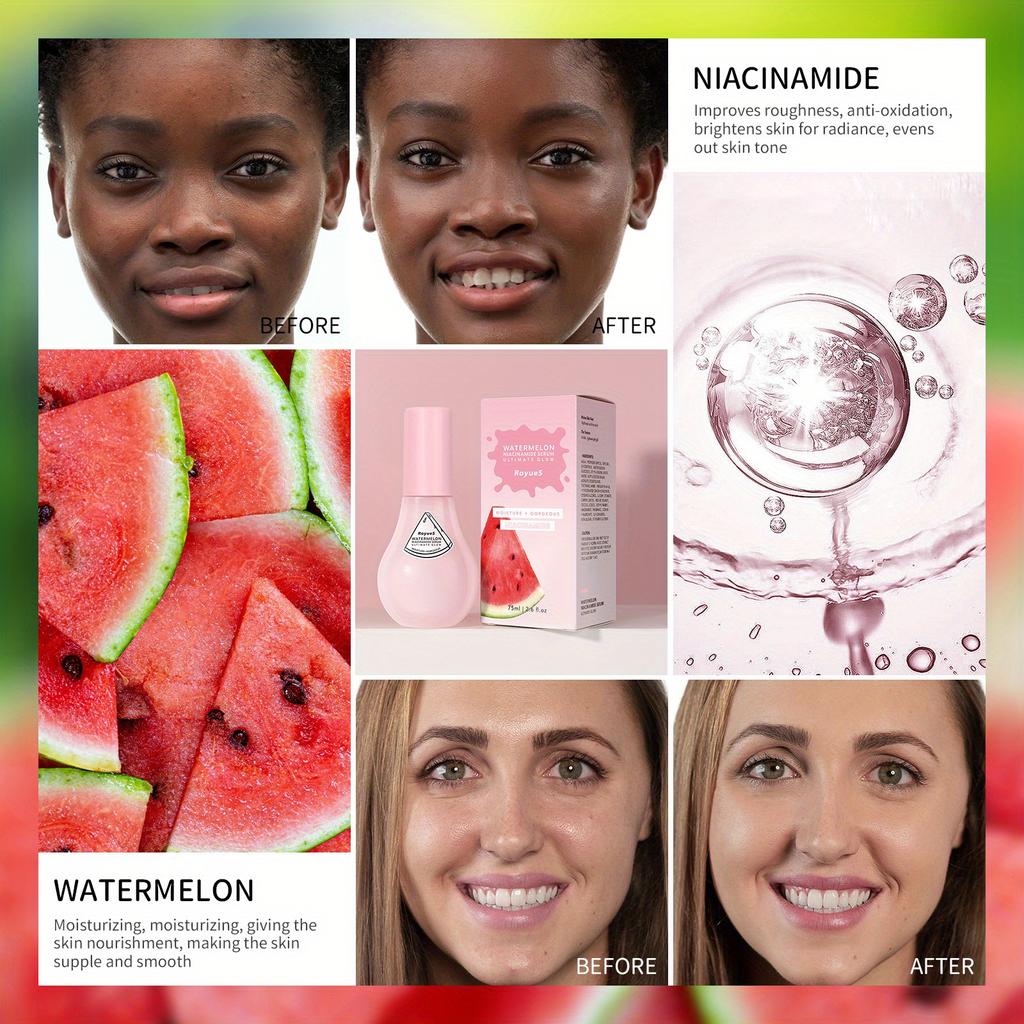 Watermelon Niacinamide Serum Facial Nourishing Moisturizing Small Bulb Serum Improve Facial Blemishes Serum 75ml