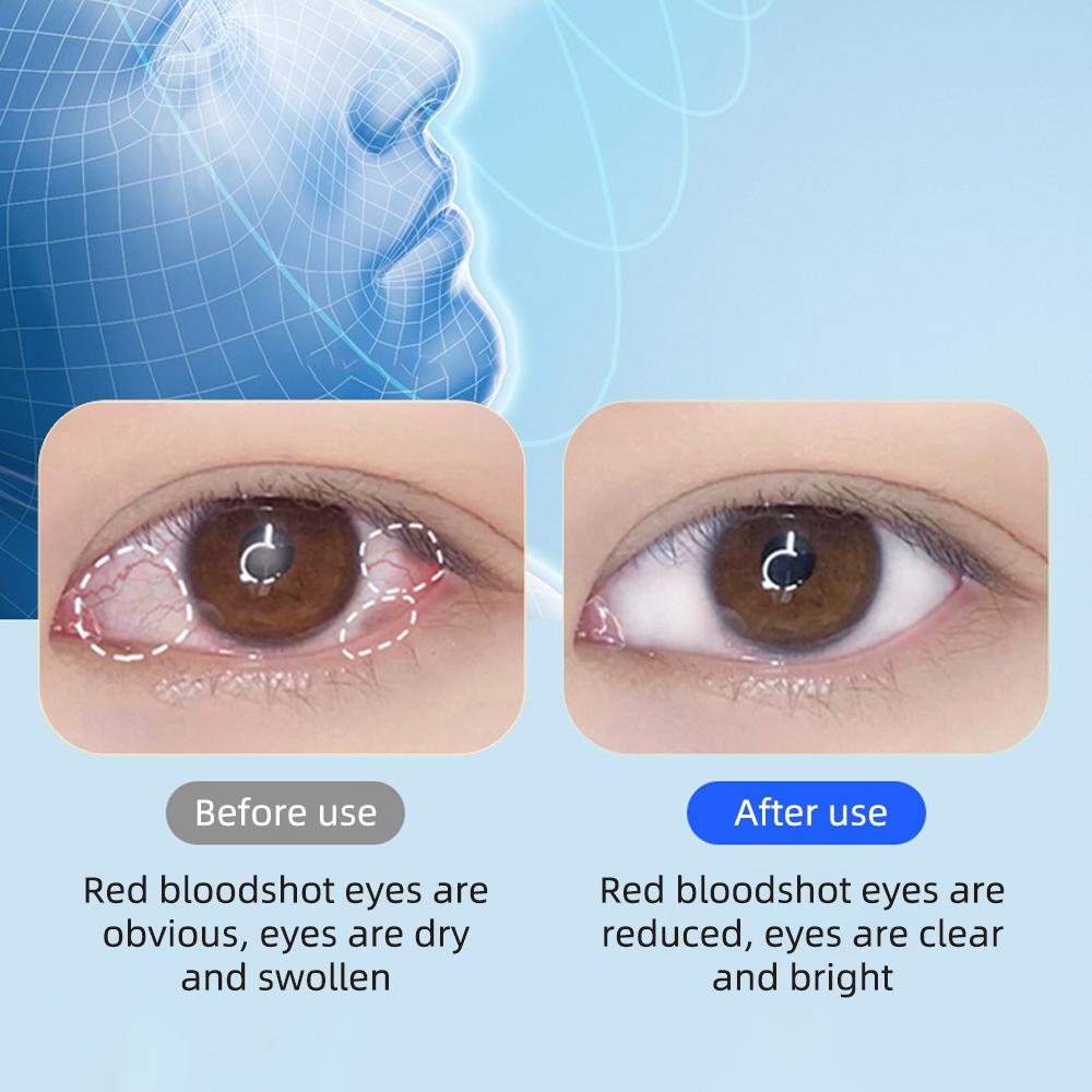 Cold and hot compress and nebulization eye moistening device