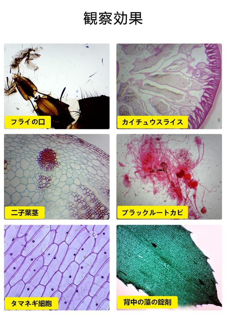 HAYEAR Digital Eyepiece for Biological 5MP Upgrades Biological Stereo Includes Ring Adapter for Biological and Stereo Microscopes Microscopes, Type-C