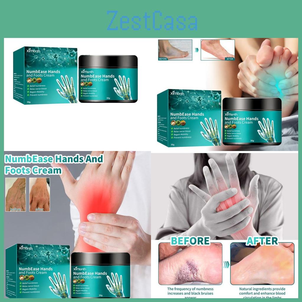 Ximonth Hand And Foot Relief Cream For Numbness And Swelling With Soothing Properties
