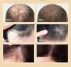 Cross-border Europe & America Hair Growth Spray: Anti-Hair Loss, Deep Nourishing Essential Oil