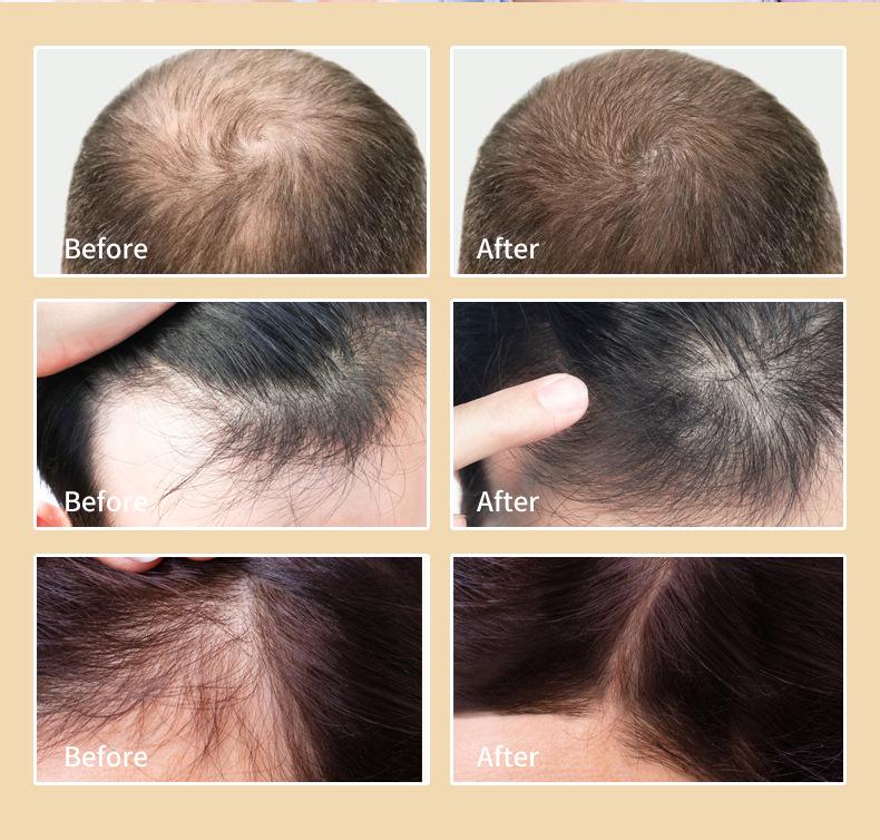 Cross-border Europe & America Hair Growth Spray: Anti-Hair Loss, Deep Nourishing Essential Oil