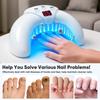 Nail Laser Fungus Device for Multiple Toenails & fingernails Nail Repair Solution for Damaged and Discolored Nails for Home Use