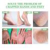 Herbal Anti Crack Foot Cream Peeling Spray Heel Cracking Repair Products Exfoliation Dead Skin Removal Softening Smooth Care