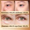 Niacinamide and Pentavalent VC Anti-aging Eye Cream Essence Improves Eye Wrinkles and Fine Lines Around The Eyes