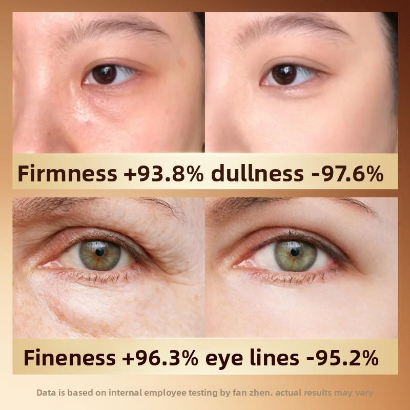 Niacinamide and Pentavalent VC Anti-aging Eye Cream Essence Improves Eye Wrinkles and Fine Lines Around The Eyes