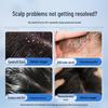 Ruyi Selenium Disulfide Anti-Dandruff Shampoo