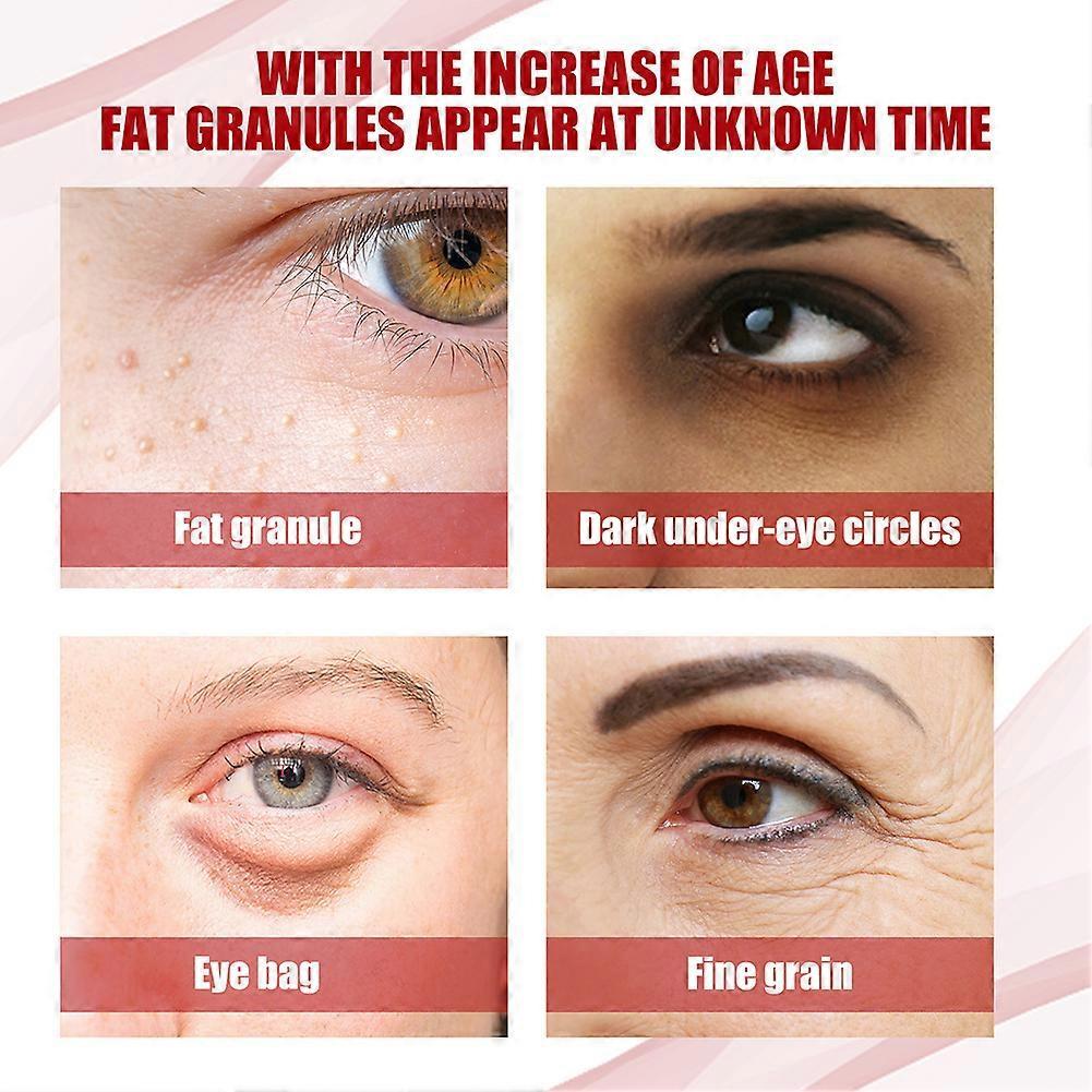 Anti Fats Granule Eye Essences Oil Fading Fine Lines Eye Bags Removal Cream Eyes Care Supplies