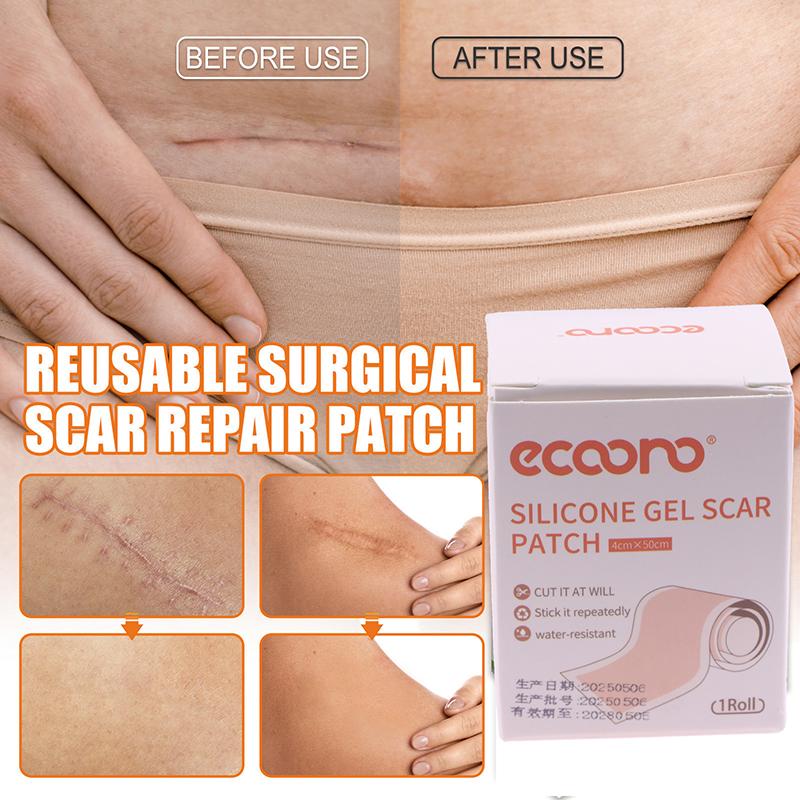 5M/Rouleau Patch Cicatrice en Silicone Rouleau de Bande Cicatrice Feuille Cicatrice Retrait Ruban Auto-Adhésif Patch Thérapeutique Brûlure Acné Cicatrice Chirurgicale Soin de la Peau