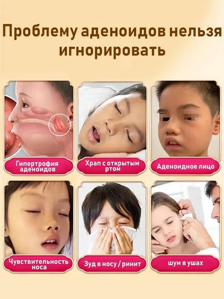 Adenoid Fat Rhinitis Nasal Congestion Sticker