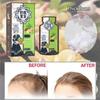 200ML Anti-Hair Loss Hair Ginger Shampoo, Nourishing Repairing Hair Shampoo, for Long/Short Hair
