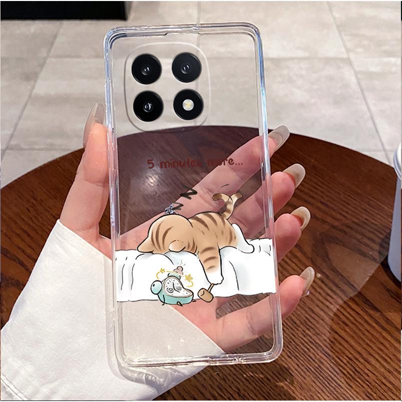 For Vivo iQOO 15 Casing Clear Luxury Cute Love Rabbit Funny Pattern Slim Soft TPU Silicone Phone Case For Vivo iQOO15 Back Cover