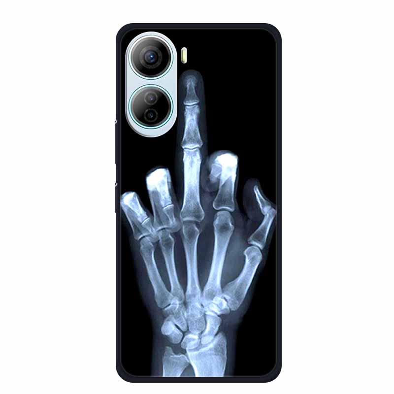 For ZTE Libero 5G IV Case Animals Silicone TPU Back Cover Soft Phone Cases for ZTE LiberoIV 5GA302 Protector Wolf Cool New Shell