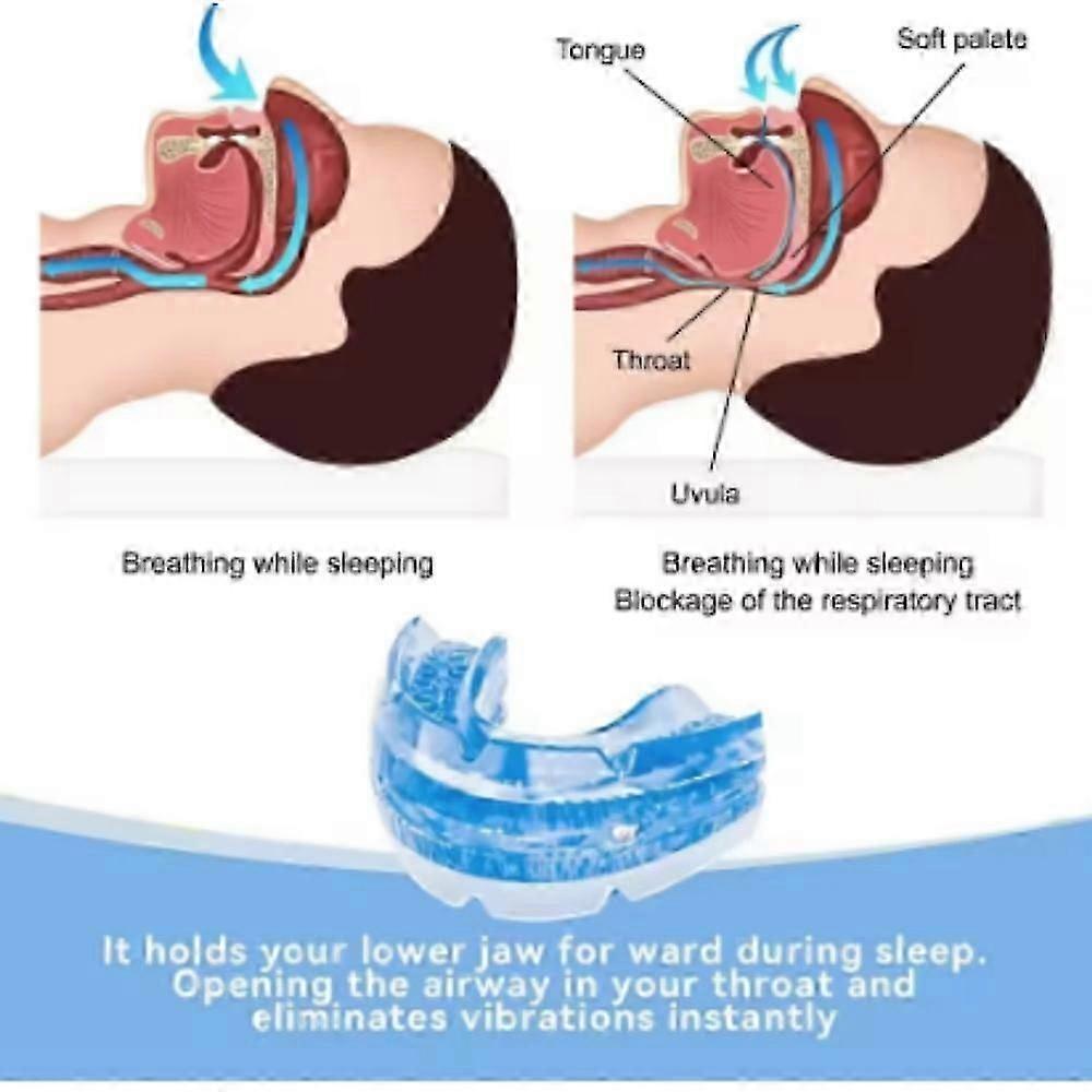 Zcomfort Anti Snoring Mouthpiece and Mouthguard for Sleep Apnea Relief_JSLV