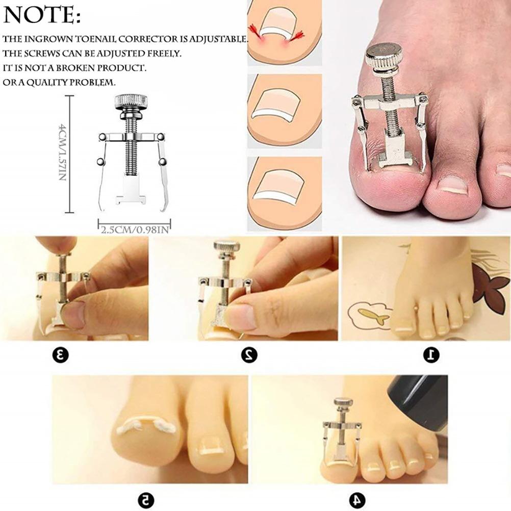 12PCS Ingrown Toenail Tool Stainless Steel Ingrown Toenail Treatment Pedicure Tools