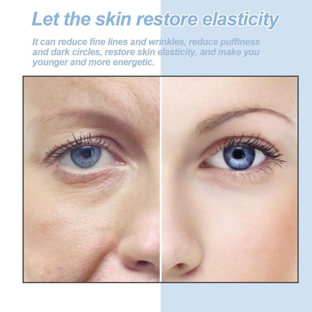 Hoygi Eye Serum: Reduces Dark Circles, Moisturizes, Refines, Tightens, and Hydrates the Eye Area.