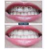 Yousheng 60ml Toothpaste Foam Deep Cleaning Stain Removal Yellowish Eliminating Whitening Teeth Refreshing Breath Teeth Foam for Beauty
