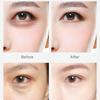 Eye Mask Moisturizing Gentle Moisturizing To Dark Circles Eye Patch Eye Care