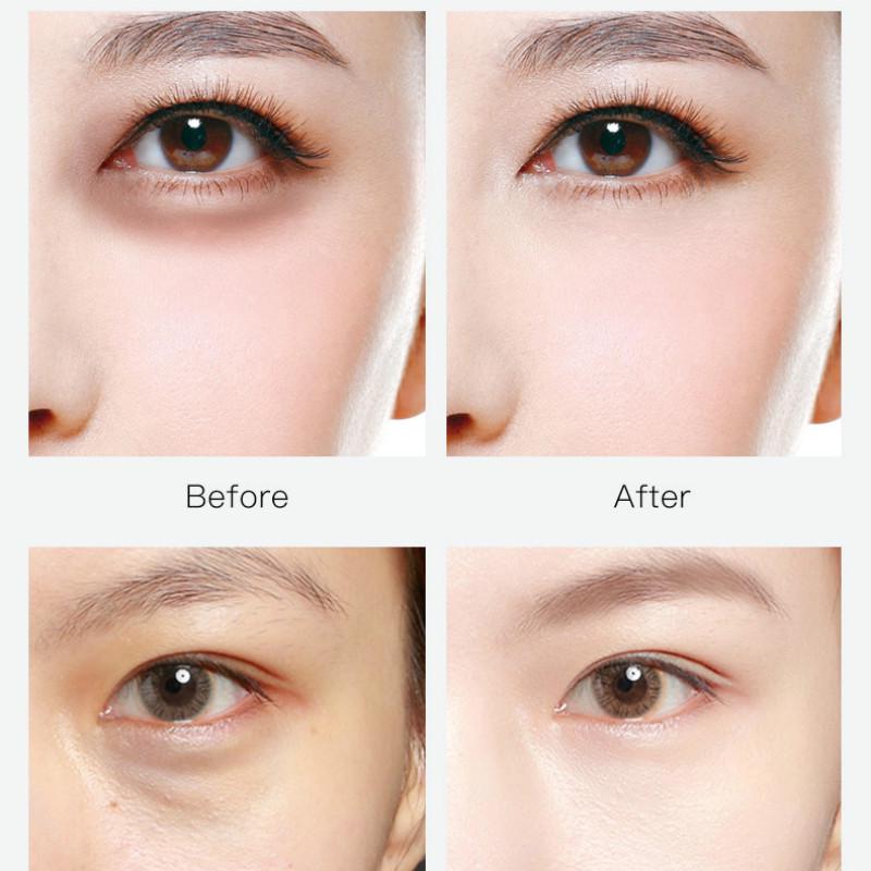 Eye Mask Moisturizing Gentle Moisturizing To Dark Circles Eye Patch Eye Care