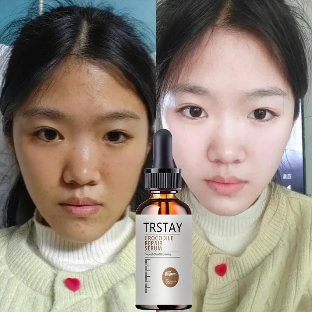 TRSTAY High Moisturizing Face Cream Moisturizing, Moisturizing, Repairing, Soothing Lotion Skin Care