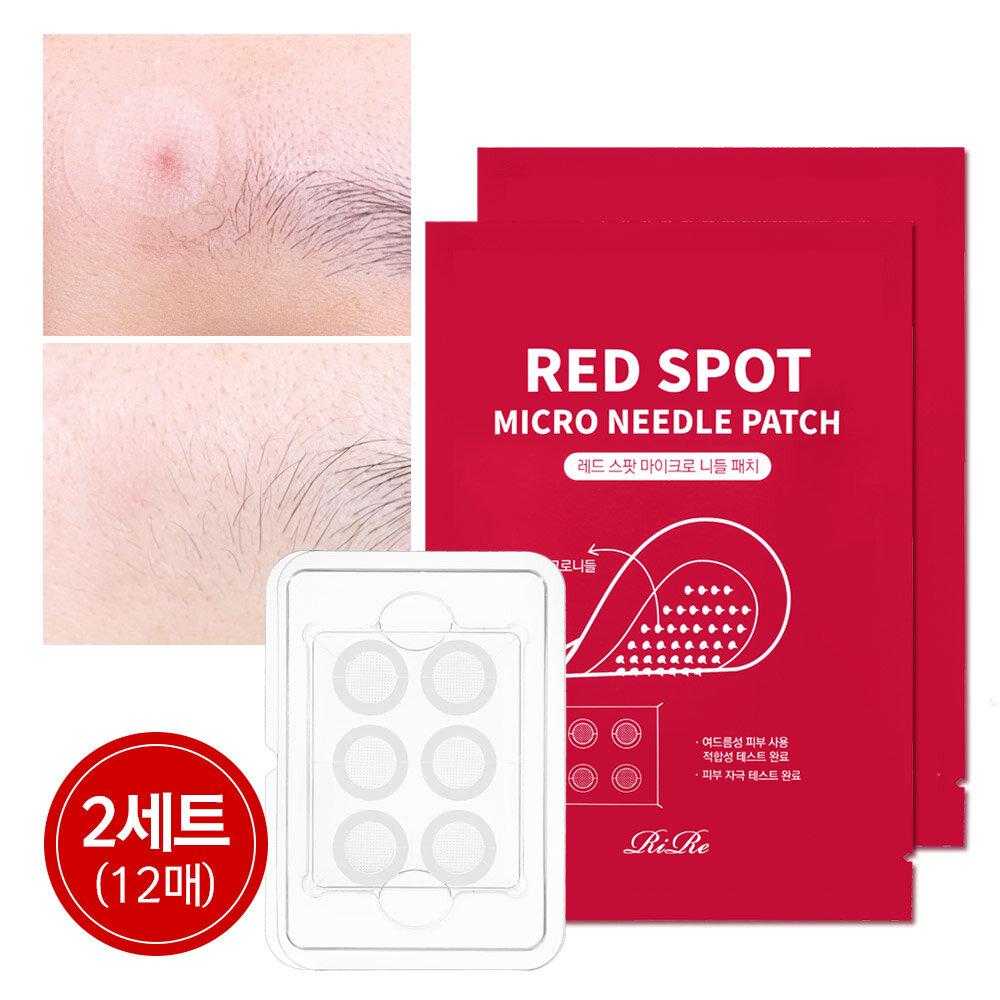 Red Spot Micro Needle Acne Patch