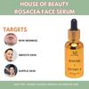 HOUSE OF BEAUTY Rosacea Face Oil with Pure cold pressed Rosehip & Vitamin E for Face Moisturizing, Suitable For Sensitive Skin Type - (30 ml)