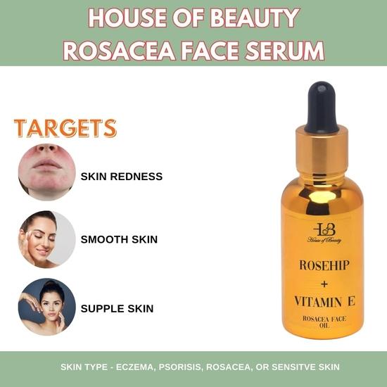 HOUSE OF BEAUTY Rosacea Face Oil with Pure cold pressed Rosehip & Vitamin E for Face Moisturizing, Suitable For Sensitive Skin Type - (30 ml)