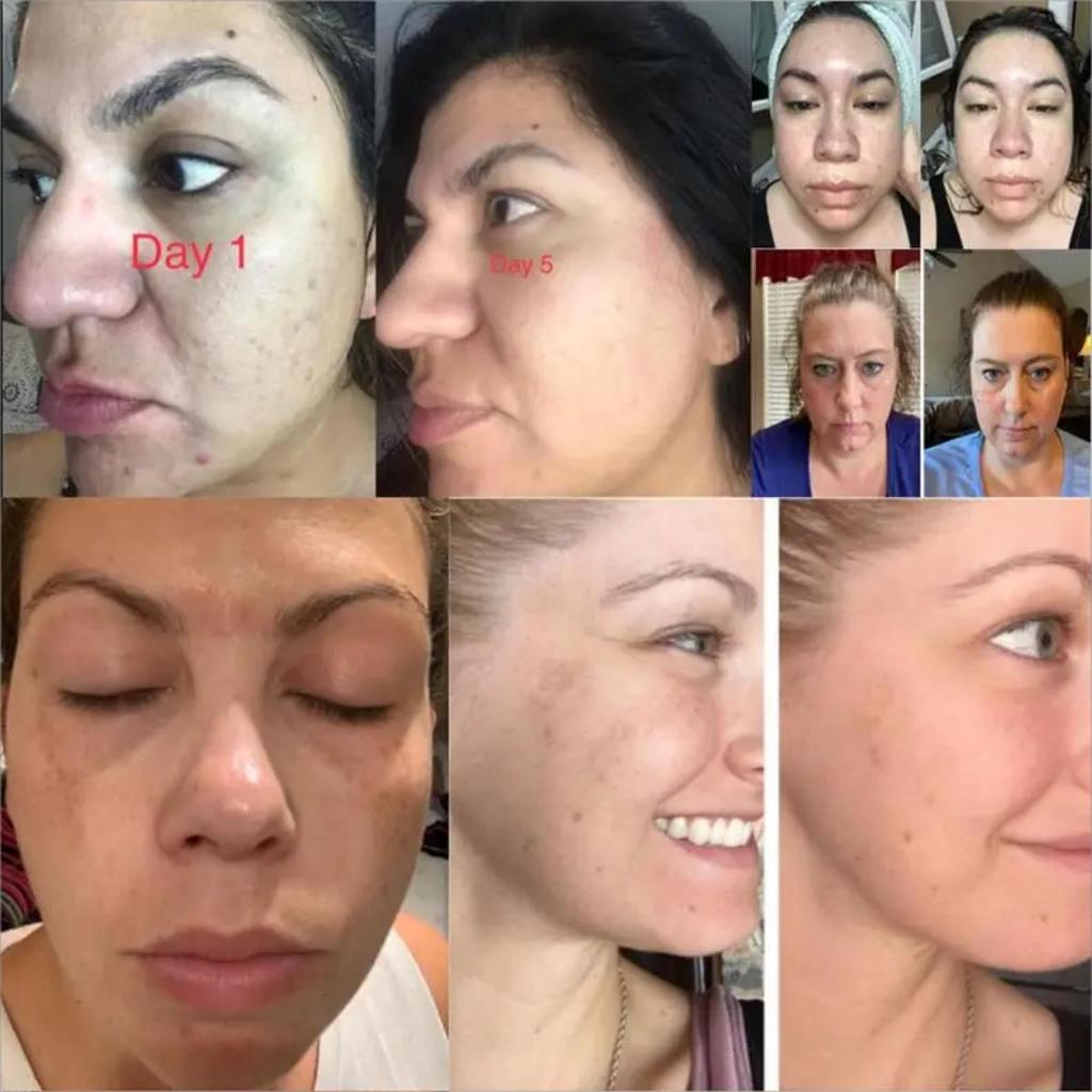 Brightening and Firming Cream, Gentle and Non-irritating, Brightens the Complexion, Tightens the Skin, and Reduces Dullness