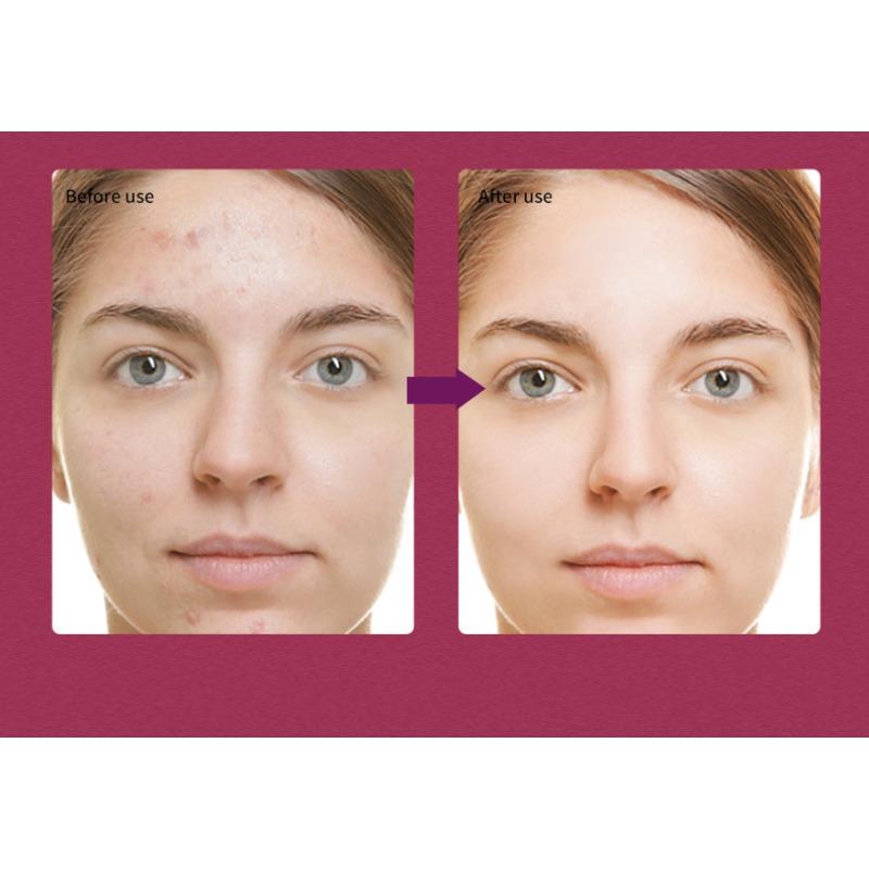 Fruit Acid Essence Hydrating and Moisturizing Facial Essence Solution